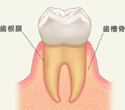 歯肉炎の状態