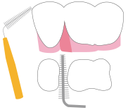 歯間ブラシ